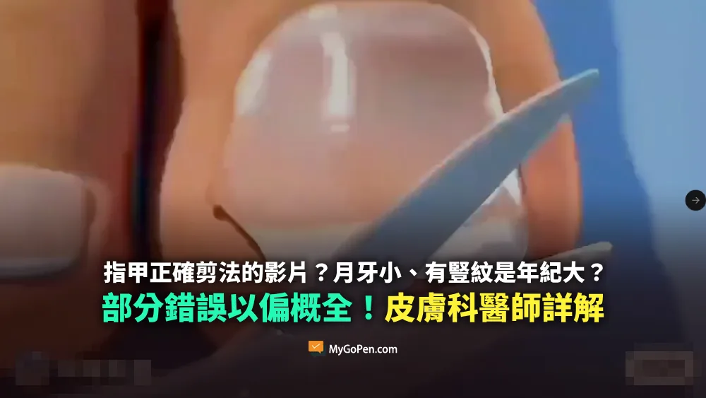 【部分錯誤】網傳指甲正確剪法的影片？月牙小、有豎紋是年紀大？以偏概全內容！醫師詳解