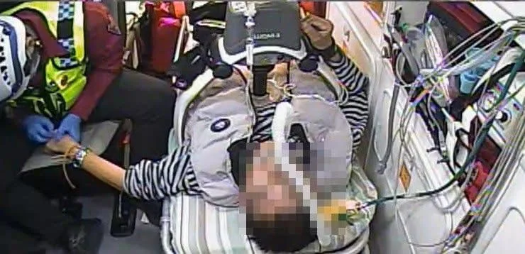 苗栗高級救護技術員使用「骨針」，將到院前已無呼吸心跳患者，急救成功康復出院首例。苗縣府提供